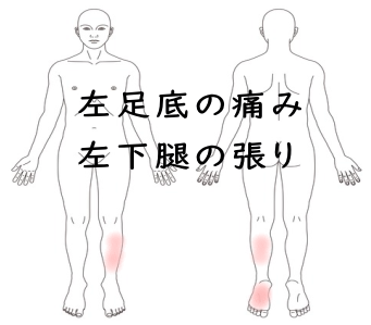 足底腱膜炎の症例