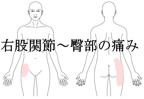 ゴルフが原因の右股関節痛の症例