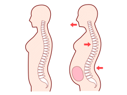 妊婦（腰）