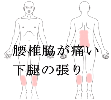 反り腰が原因だった腰痛の症例